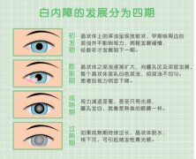 你是我的眼——瑞博医院眼科见闻