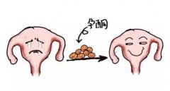 怀孕孕酮值下降的原因有哪些